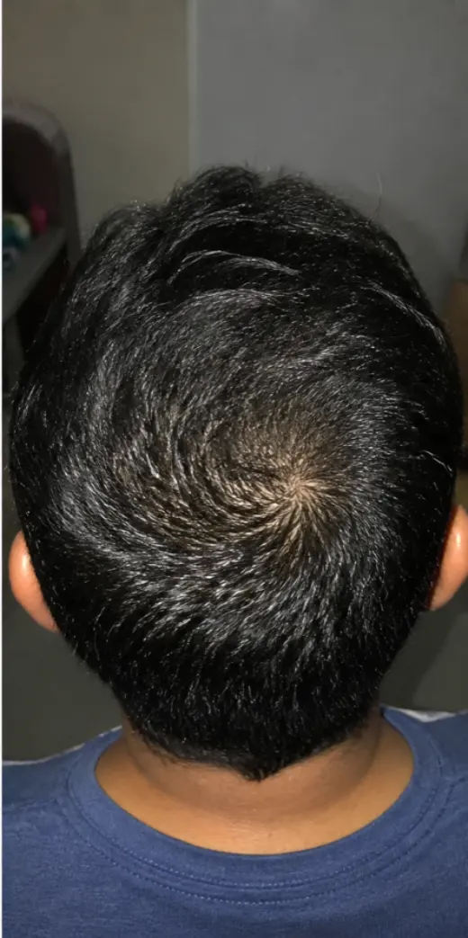 Emiliano C., after 4 months of use