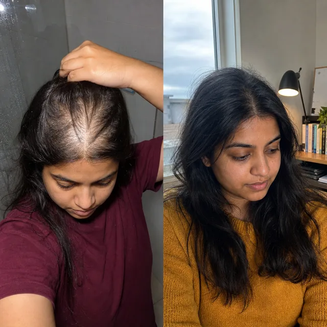 Scalp of Daria Quispe before starting the routine and after 8 months