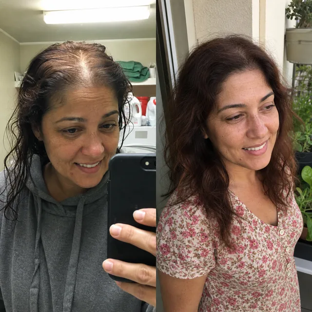 Scalp of Flavia Rojas before starting the routine and after 7 months
