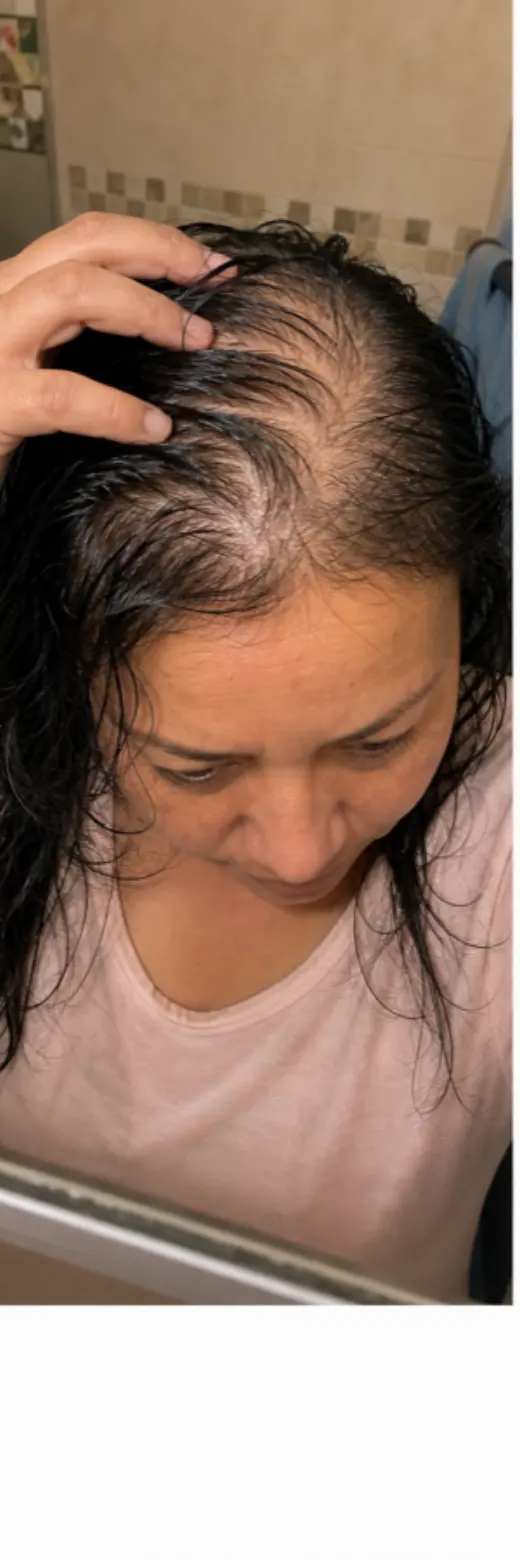 Carmen S., before starting