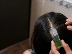 A hand rests the microneedle along the parting of the hair, seen from above